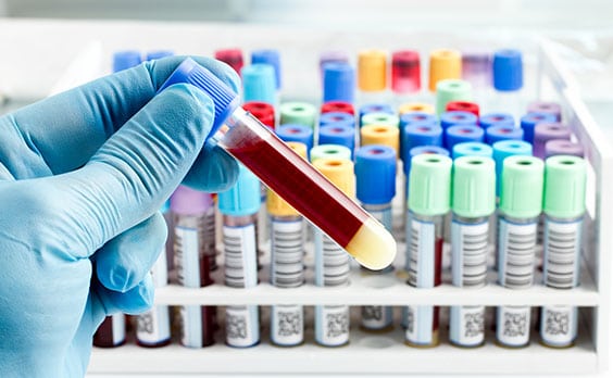 toxicology testing lab in los angeles corona pathology