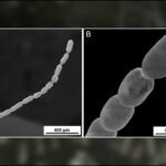 biggestbacteriax