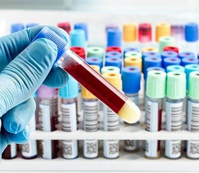 toxicology testing lab in los angeles corona pathology
