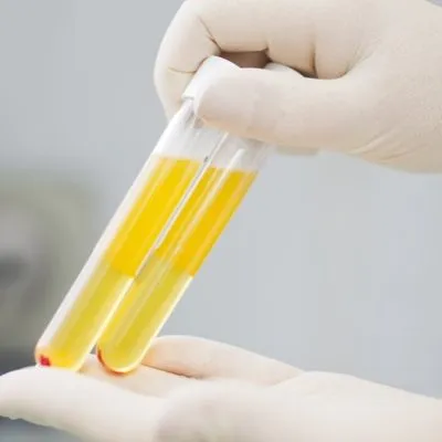 plasma therapy for corona